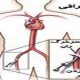 انواع آنژیوگرافی قلب