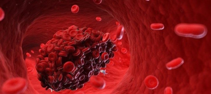 داروهایی که برای جلوگیری از لخته شدن خون در پلاکت ها کمک می کند