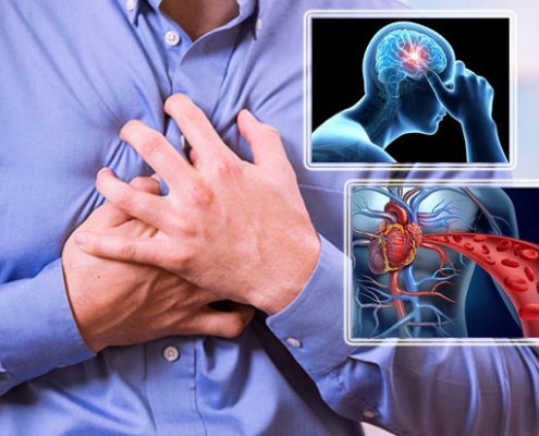 دلایل بیماری قلبی و سکته مغزی