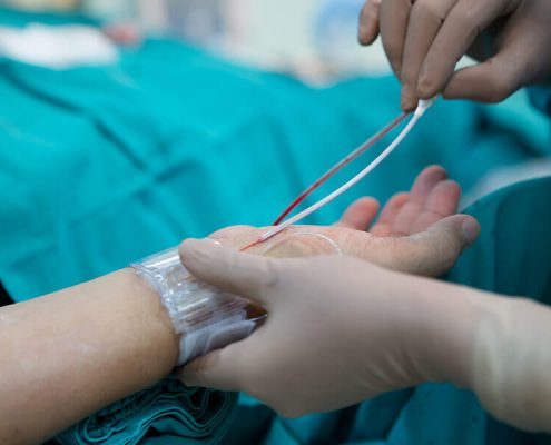 انژیوگرافی از دست دکتر جوزانی کهن