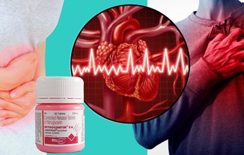 Effects of nitroglycerin on heart diseases
