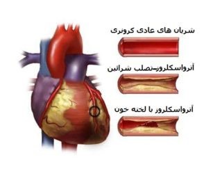 تاثیرات داروهای قلبی بر روی جنین چیست؟!