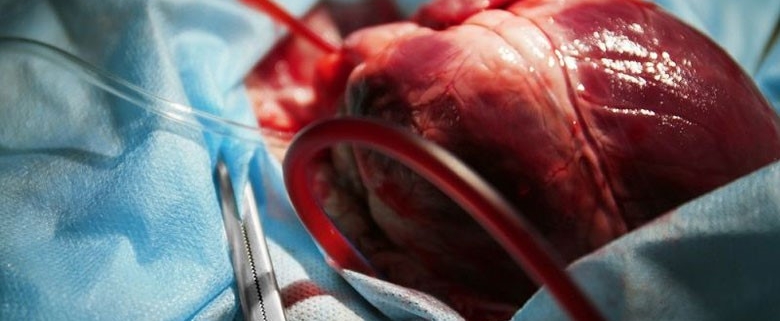 نحوه انجام ترمیم دریچه قلب و یا جایگزینی