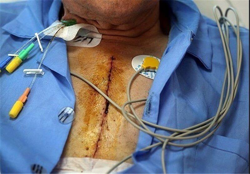 عوارض عمل قلب باز عوارض عمل قلب باز