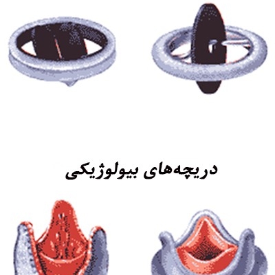 ترمیم دریچه میترال چگونه است؟