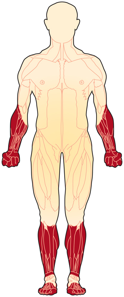 میوپاتی