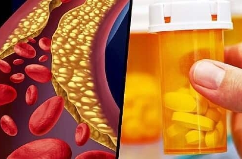 داروهای مناسب جهت کاهش سطح کلسترول:-وب سایت دکتر جوزانی