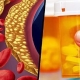 داروهای مناسب جهت کاهش سطح کلسترول:-وب سایت دکتر جوزانی