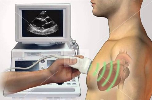 آزمایش اکوکاردیوگرام استرس چگونه است؟