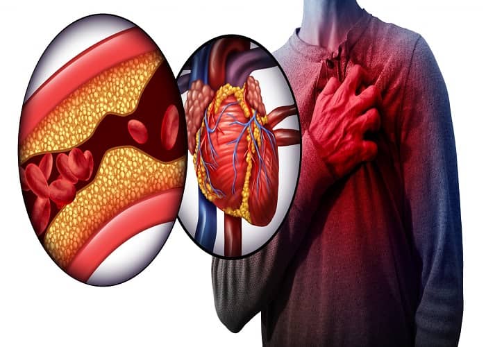 تشخیص بیماری قلبی با استفاده از اکو