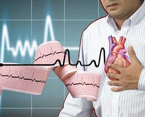نوار قلب؛ بهترین راه تشخیص بیماری قلبی است؟