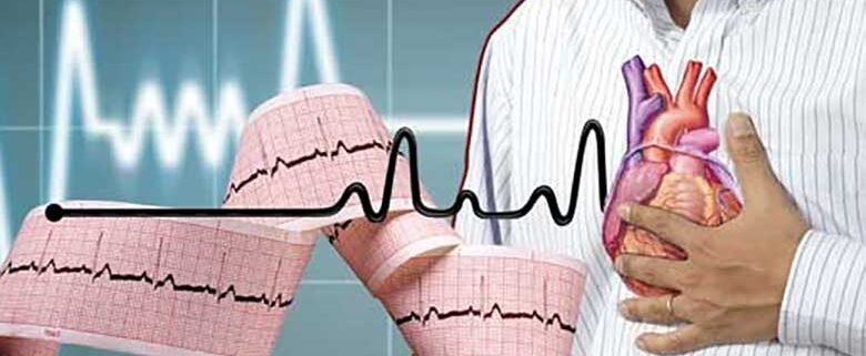 نوار قلب؛ بهترین راه تشخیص بیماری قلبی است؟